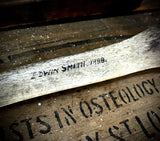 Human tibia (shinbone)