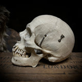 Medically prepared human skull