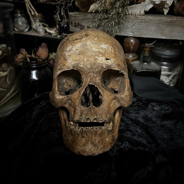 Human skull