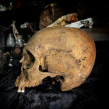 Human skull