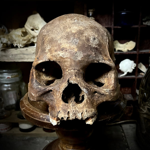 Human skull