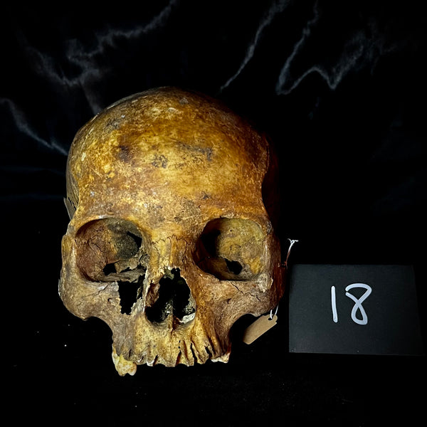 Item 18. Human skull