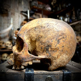 Human skull
