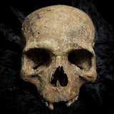 Human skull