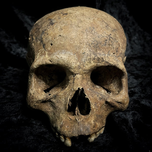 Human skull