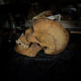 Human skull