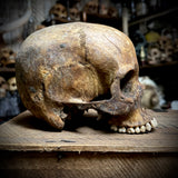 Human skull