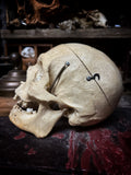 Medically prepared human skull