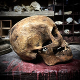 Human skull with mandible
