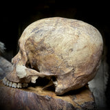 Human skull