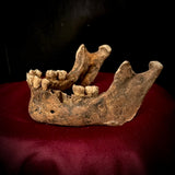 A mandible