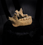 A mandible