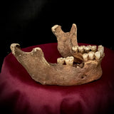 A mandible