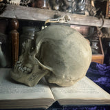 Medically prepared human skull