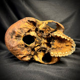 Item 11. Human skull