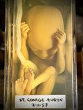 Foetal specimen