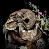 A human skull with mandible