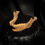 A mandible