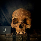Item 3. Human skull