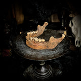 A mandible