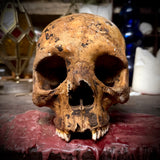 Human skull