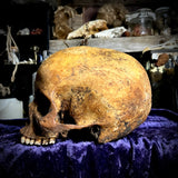 Human skull