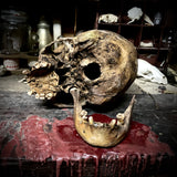 Human skull with mandible