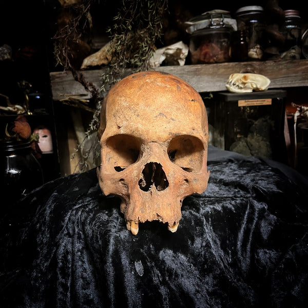 Human skull
