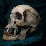 Medically prepared human skull