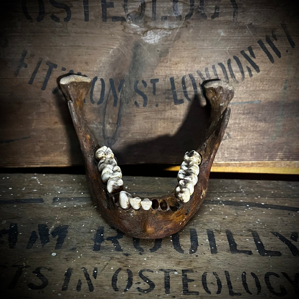 A mandible