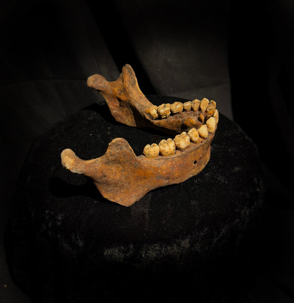 A mandible