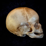 Item 1. Human fetal skull