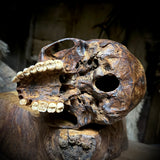Human skull