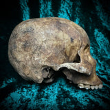 Human skull *COMPETITION*