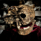 A human skull with mandible