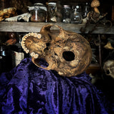 Human skull