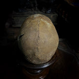 Human skull