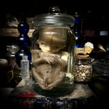 Fetal specimen