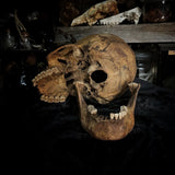 Human skull