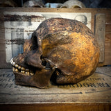 Human skull with mandible