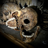 Human skull with mandible