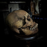 Human skull