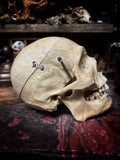 Medically prepared human skull