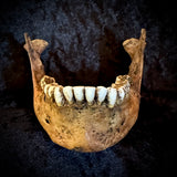 Item 7. A human mandible