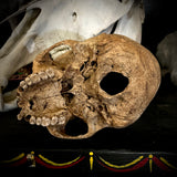 Human skull
