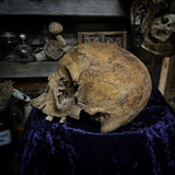 Human skull