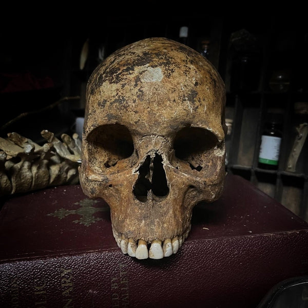 Human skull