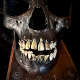Item 2. Brass tooth skull