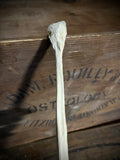 Human fibula (lower leg bone)