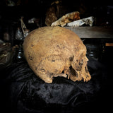 Human skull